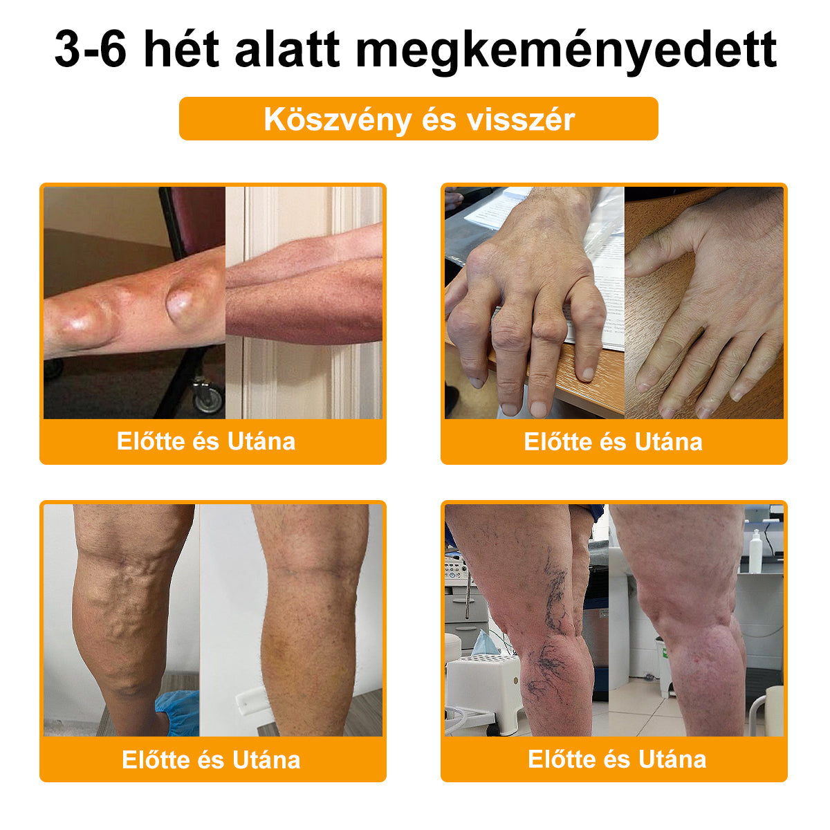 ADNOON® Botulinum Toxin & Méhméreg Fájdalomcsillapító Csontgyógyító Krém⭐👨‍⚕️A Magyar Ortopéd Társaság (MOT) Által Jóváhagyva