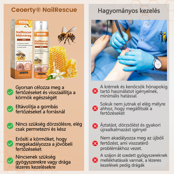 2025🎁 Korlátozott idejű akció 70% kedvezménnyel ️️⏳ Ceoerty® körömgomba spray méhméreggel 💥 2 hét alatt megoldja az összes körömproblémát