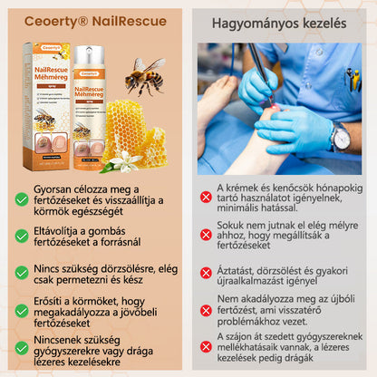 2025🎁 Korlátozott idejű akció 70% kedvezménnyel ️️⏳ Ceoerty® körömgomba spray méhméreggel 💥 2 hét alatt megoldja az összes körömproblémát