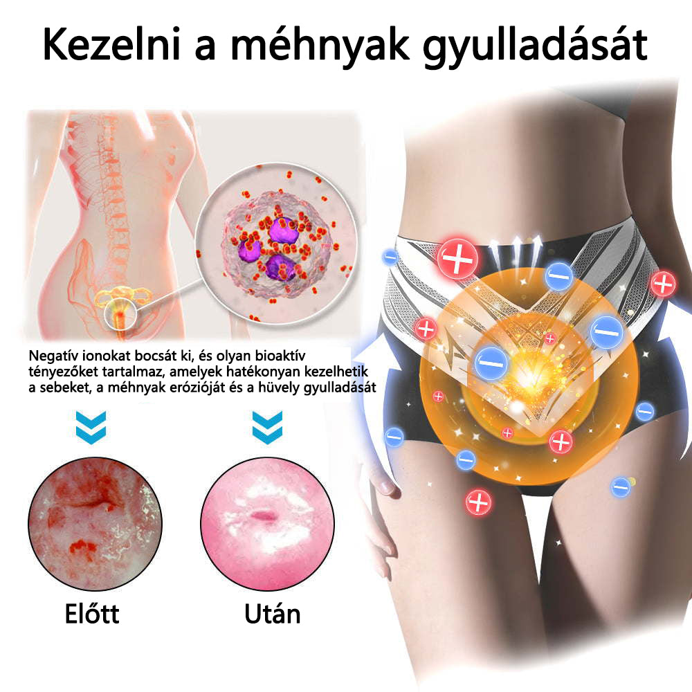 🎉 Korlátozott idejű ajánlat - hatalmas kedvezmény! 🔥 Akár 90% KEDVEZMÉNY! Sfrcord™ titánszálas önmelegedő turmalin formáló rövidnadrág✅✅