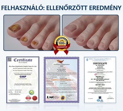 ✨ Timilk® ✨ – 🌿 Gyógynövényes gombaellenes spray körömre és bőrre 🦶
