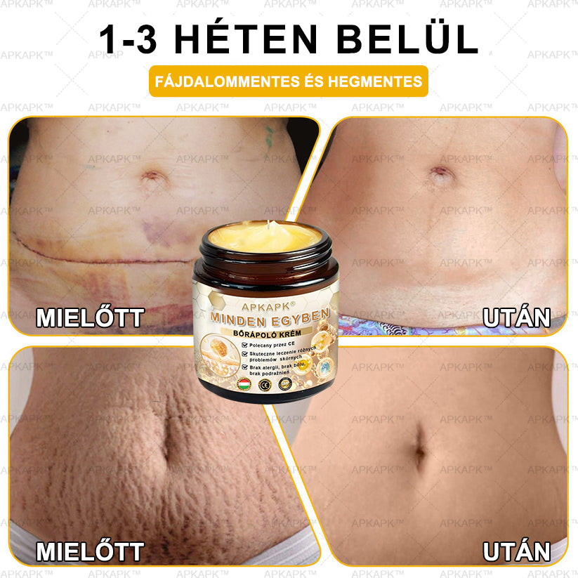 𝐀𝐏𝐊𝐀𝐏𝐊™MéhméregBőrápoló Krém - Jóváhagyva a MagyarDermatológiaiésVenereológiai Társaság (MDDK) és a Nemzeti Népegészségügyi Központ (NNK) által.