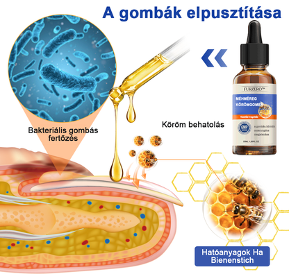 🐝🐝Furzero™ méhméreg körömgomba kezelési megoldás:Teljesen megoldja a körömgomba problémát🌟👣