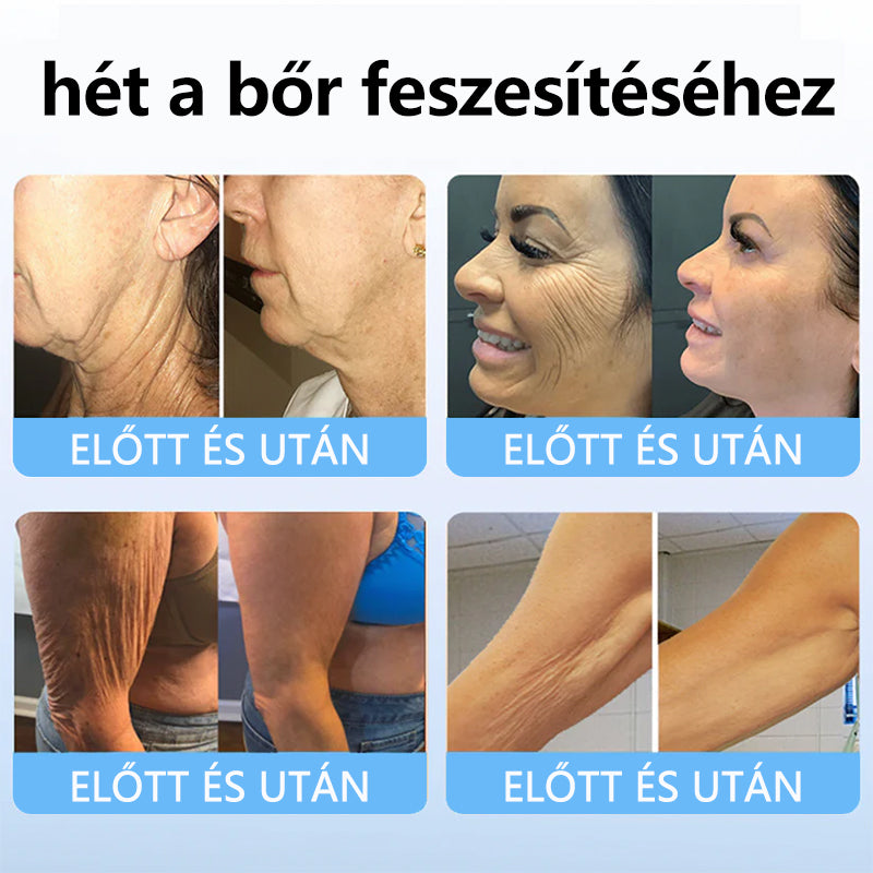 TLOPA™ Kollagén Peptid Erősítő Szérum Stift🎄🎄🎄-Az Országos Népegészségügyi Intézet [NNK] és a Magyar Bőrgyógyászati Társaság [MDDK] ajánlásával.