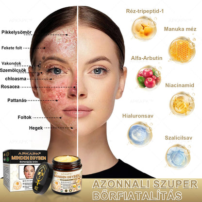 𝐀𝐏𝐊𝐀𝐏𝐊™MéhméregBőrápoló Krém - Jóváhagyva a MagyarDermatológiaiésVenereológiai Társaság (MDDK) és a Nemzeti Népegészségügyi Központ (NNK) által.