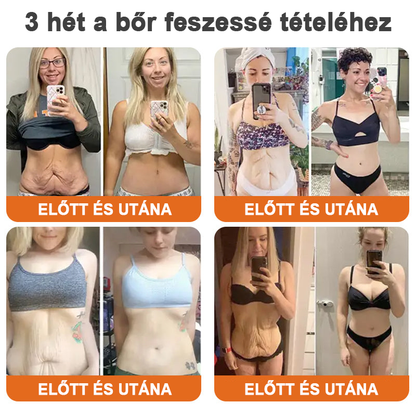 ✨Flysmus™ szérum botox méhméreggel való feszesítéshez🔥UTOLSÓ NAP 70% KEDVEZMÉNY