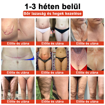 STDEI™ MÁGIKUS LUXUS TESTOLAJ (Korlátozott ideig 80% kedvezmény - Utolsó 30 perc)🌹🔥