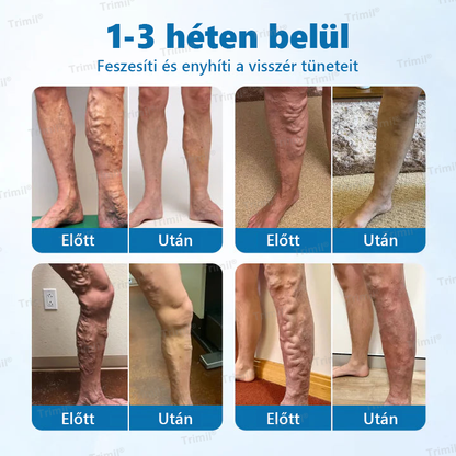🌿🌿Trimil® VeinGuard Gyógynövényes Spray - ✅ Klinikailag bizonyított, hogy mindössze 7 nap alatt megszünteti a visszereket!