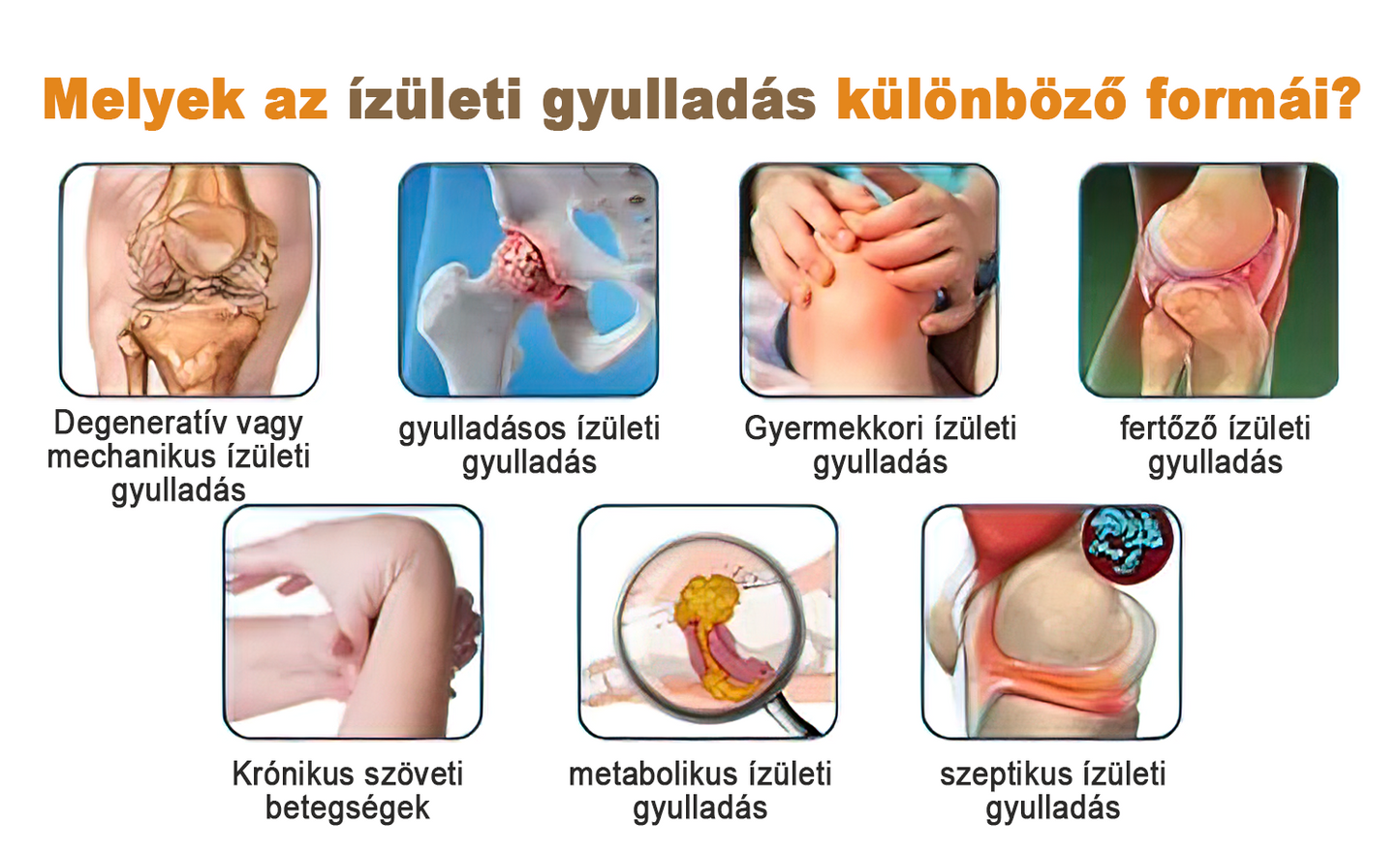 🏆🌈Zoencgz™ méhméreg ízületi gyulladás és visszér kezelő krém✨