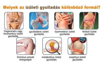 🏆🌈Zoencgz™ méhméreg ízületi gyulladás és visszér kezelő krém✨