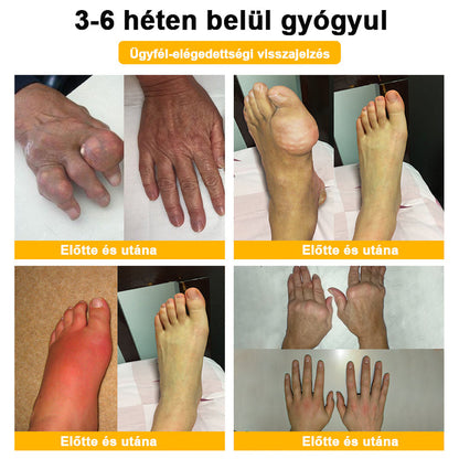 ADNOON® Botulinum Toxin & Méhméreg Fájdalomcsillapító Csontgyógyító Krém⭐👨‍⚕️A Magyar Ortopéd Társaság (MOT) Által Jóváhagyva
