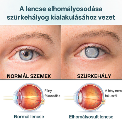 Timilk® OptiFusion Nano szemcsepp szérum🪞