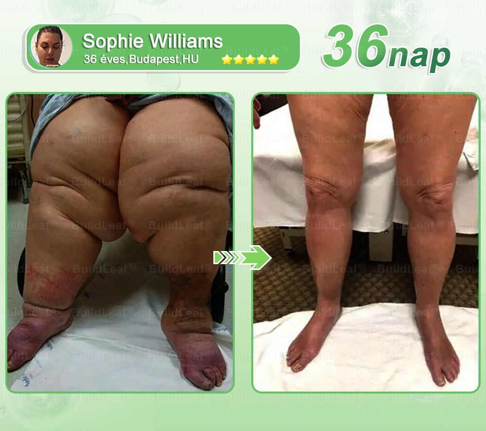 BuildLeaf®🥇 GLP-1 8-az-1-ben Fit &amp; Vital Orális Oldat (Csak napi egyszer, látható változások 7 nap alatt)  Elhízásra, szív- és érrendszeri egészségre, cukorbetegségre, alvási apnoéra, emésztőrendszeri egészségre, ízületi problémákra és még sok másra