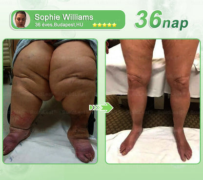 BuildLeaf®🥇 GLP-1 8-az-1-ben Fit &amp; Vital Orális Oldat (Csak napi egyszer, látható változások 7 nap alatt)  Elhízásra, szív- és érrendszeri egészségre, cukorbetegségre, alvási apnoéra, emésztőrendszeri egészségre, ízületi problémákra és még sok másra