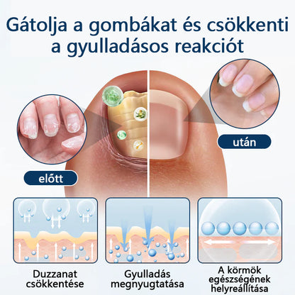 ✨ Timilk® ✨ – 🌿 Gyógynövényes gombaellenes spray körömre és bőrre 🦶