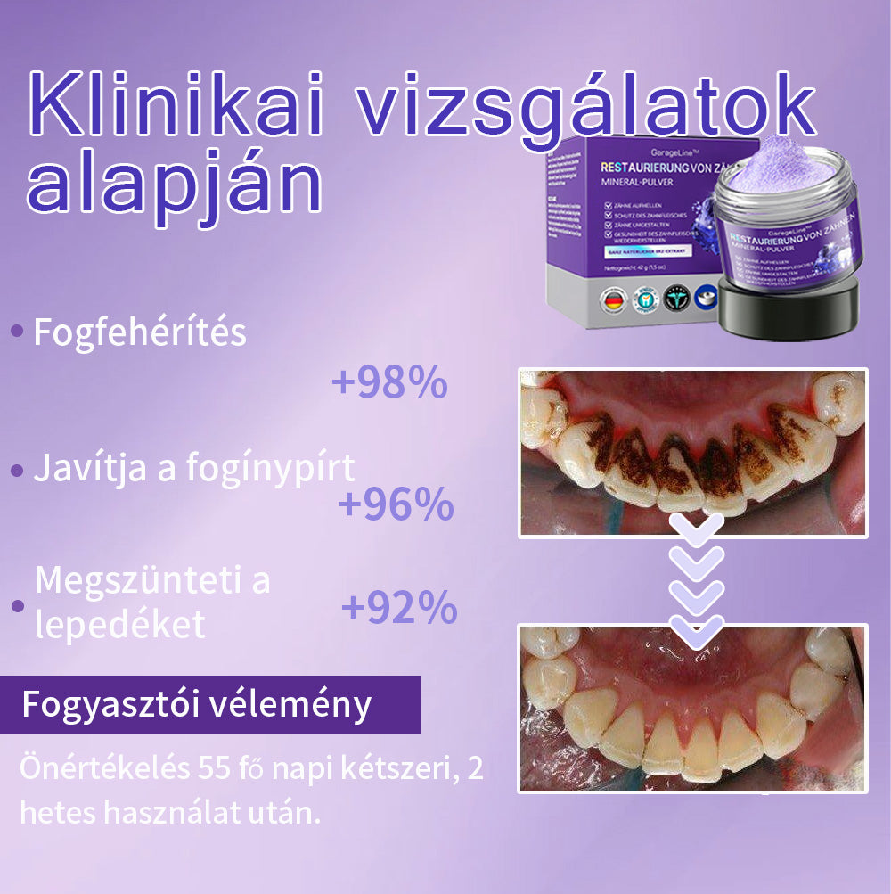 𝖦𝖺𝗋𝖺𝗀𝖾𝖫𝗂𝗇𝖾™ 𝖥𝗈𝗀𝖺𝗄 𝗁𝖾𝗅𝗒𝗋𝖾á𝗅𝗅í𝗍á𝗌𝖺 Á𝗌𝗏á𝗇𝗒𝗂 𝗉𝗈𝗋🦷 (MFK által ajánlott) (👨🏻‍⚕️(Korlátozott idejű ajánlat - ne hagyja ki)👨🏻‍⚕️)
