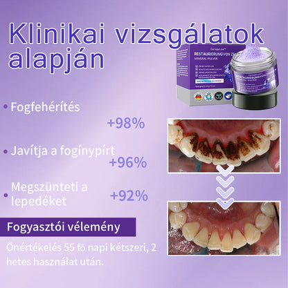 𝖦𝖺𝗋𝖺𝗀𝖾𝖫𝗂𝗇𝖾™ 𝖥𝗈𝗀𝖺𝗄 𝗁𝖾𝗅𝗒𝗋𝖾á𝗅𝗅í𝗍á𝗌𝖺 Á𝗌𝗏á𝗇𝗒𝗂 𝗉𝗈𝗋🦷 (MFK által ajánlott) (👨🏻‍⚕️(Korlátozott idejű ajánlat - ne hagyja ki)👨🏻‍⚕️)