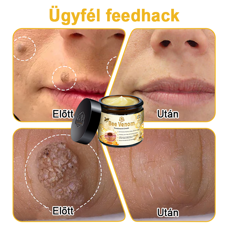 🏵️[Hivatalos zászlóshajó üzlet] 𝑻𝒖𝒓𝒐𝒏𝒖™ méhméreg bőrápoló krém (👨‍⚕𝐀𝐀𝐃 JAVASLATOK)