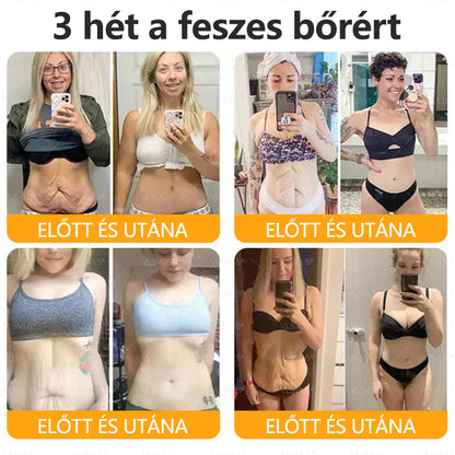 💐🌟💐Magyarországon készült és szállítva✨ VLSVLS® Méhméreg Bőrjavító Krém🔥 Utolsó nap 80% kedvezmény