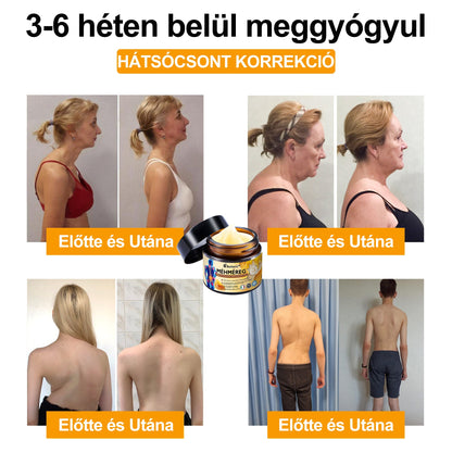 𝑯𝒊𝒗𝒂𝒕𝒂𝒍𝒐𝒔 𝒃𝒐𝒍𝒕: 𝑨𝒆𝒕𝒉𝒆𝒓𝒊𝒔™ 𝑴é𝒉𝒎é𝒓𝒆𝒈 𝑨𝒛𝒐𝒏𝒏𝒂𝒍𝒊 𝑼𝒍𝒕𝒓𝒂 𝑬𝒓ő𝒔 𝑭á𝒋𝒅𝒂𝒍𝒐𝒎𝒄𝒔𝒊𝒍𝒍𝒂𝒑í𝒕ó 𝑲𝒓é𝒎 - 💪💪(𝑬𝒏𝒚𝒉í𝒕𝒊 𝒂 𝒇á𝒋𝒅𝒂𝒍𝒎𝒂𝒕 í𝒛ü𝒍𝒆𝒕𝒊 𝒈𝒚𝒖𝒍𝒍𝒂𝒅á𝒔, 𝒊𝒛𝒐𝒎𝒇á𝒋𝒅𝒂𝒍𝒐𝒎, 𝒉á𝒕𝒇á𝒋á𝒔, 𝒕é𝒓𝒅𝒆𝒌, 𝒉á𝒕, 𝒗á𝒍𝒍𝒂𝒌, 𝒄𝒔í𝒑ő𝒌, 𝒄𝒔𝒖𝒌𝒍ó𝒌, 𝒌𝒆𝒛𝒆𝒌 𝒆𝒔𝒆𝒕é𝒏)