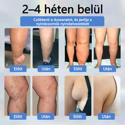 💧ATTDX® Növényi ödéma enyhítő krém nigellával