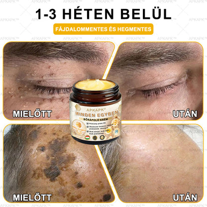 𝐀𝐏𝐊𝐀𝐏𝐊™MéhméregBőrápoló Krém - Jóváhagyva a MagyarDermatológiaiésVenereológiai Társaság (MDDK) és a Nemzeti Népegészségügyi Központ (NNK) által.