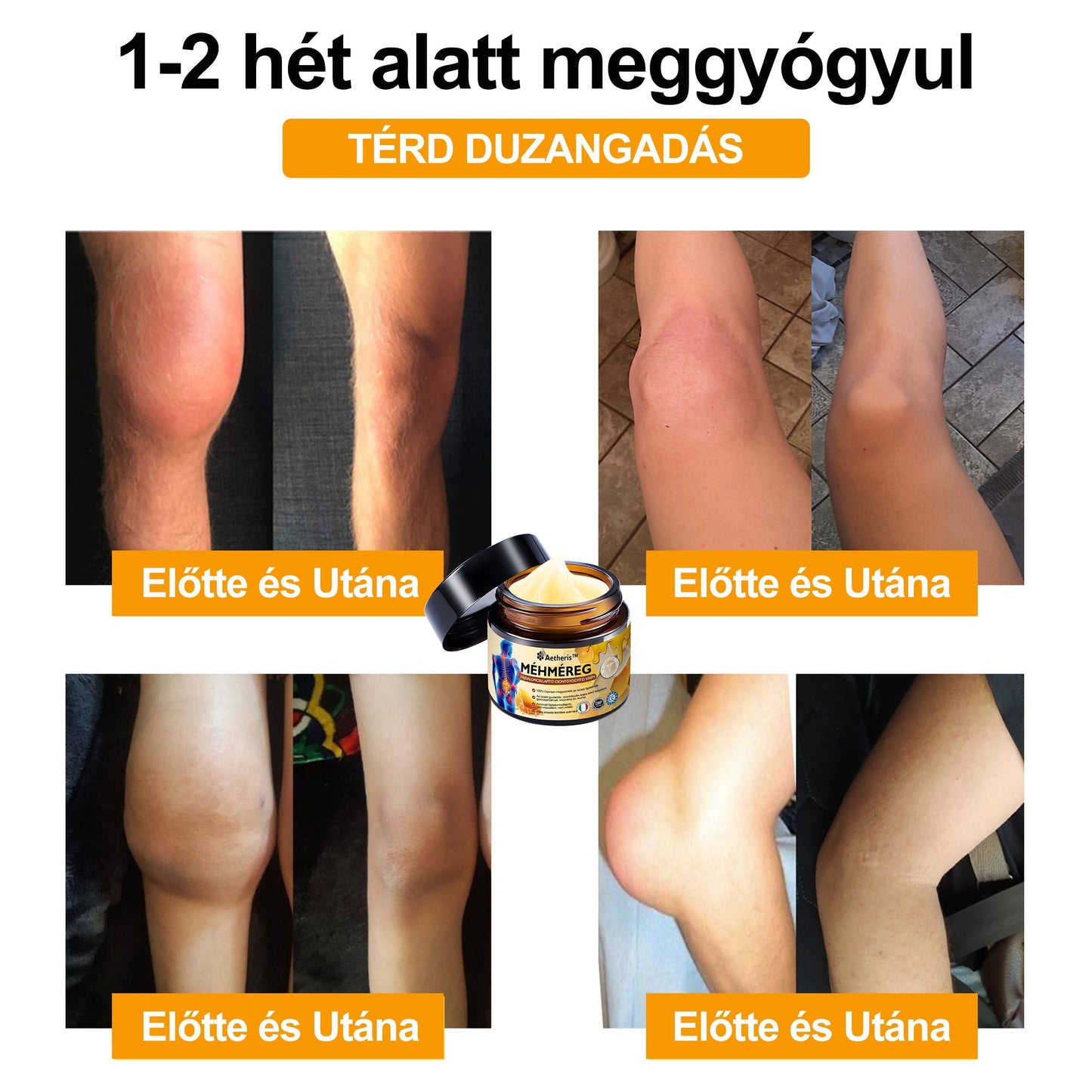 𝑯𝒊𝒗𝒂𝒕𝒂𝒍𝒐𝒔 𝒃𝒐𝒍𝒕: 𝑨𝒆𝒕𝒉𝒆𝒓𝒊𝒔™ 𝑴é𝒉𝒎é𝒓𝒆𝒈 𝑨𝒛𝒐𝒏𝒏𝒂𝒍𝒊 𝑼𝒍𝒕𝒓𝒂 𝑬𝒓ő𝒔 𝑭á𝒋𝒅𝒂𝒍𝒐𝒎𝒄𝒔𝒊𝒍𝒍𝒂𝒑í𝒕ó 𝑲𝒓é𝒎 - 💪💪(𝑬𝒏𝒚𝒉í𝒕𝒊 𝒂 𝒇á𝒋𝒅𝒂𝒍𝒎𝒂𝒕 í𝒛ü𝒍𝒆𝒕𝒊 𝒈𝒚𝒖𝒍𝒍𝒂𝒅á𝒔, 𝒊𝒛𝒐𝒎𝒇á𝒋𝒅𝒂𝒍𝒐𝒎, 𝒉á𝒕𝒇á𝒋á𝒔, 𝒕é𝒓𝒅𝒆𝒌, 𝒉á𝒕, 𝒗á𝒍𝒍𝒂𝒌, 𝒄𝒔í𝒑ő𝒌, 𝒄𝒔𝒖𝒌𝒍ó𝒌, 𝒌𝒆𝒛𝒆𝒌 𝒆𝒔𝒆𝒕é𝒏)