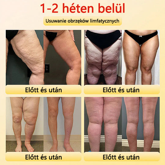 🎉 Korlátozott idejű ajánlat - hatalmas kedvezmény! 🔥 Akár 90% KEDVEZMÉNY! Sfrcord™ titánszálas önmelegedő turmalin formáló rövidnadrág✅✅