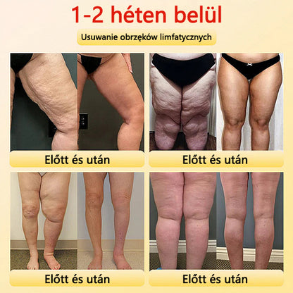 🎉 Korlátozott idejű ajánlat - hatalmas kedvezmény! 🔥 Akár 90% KEDVEZMÉNY! Sfrcord™ titánszálas önmelegedő turmalin formáló rövidnadrág✅✅
