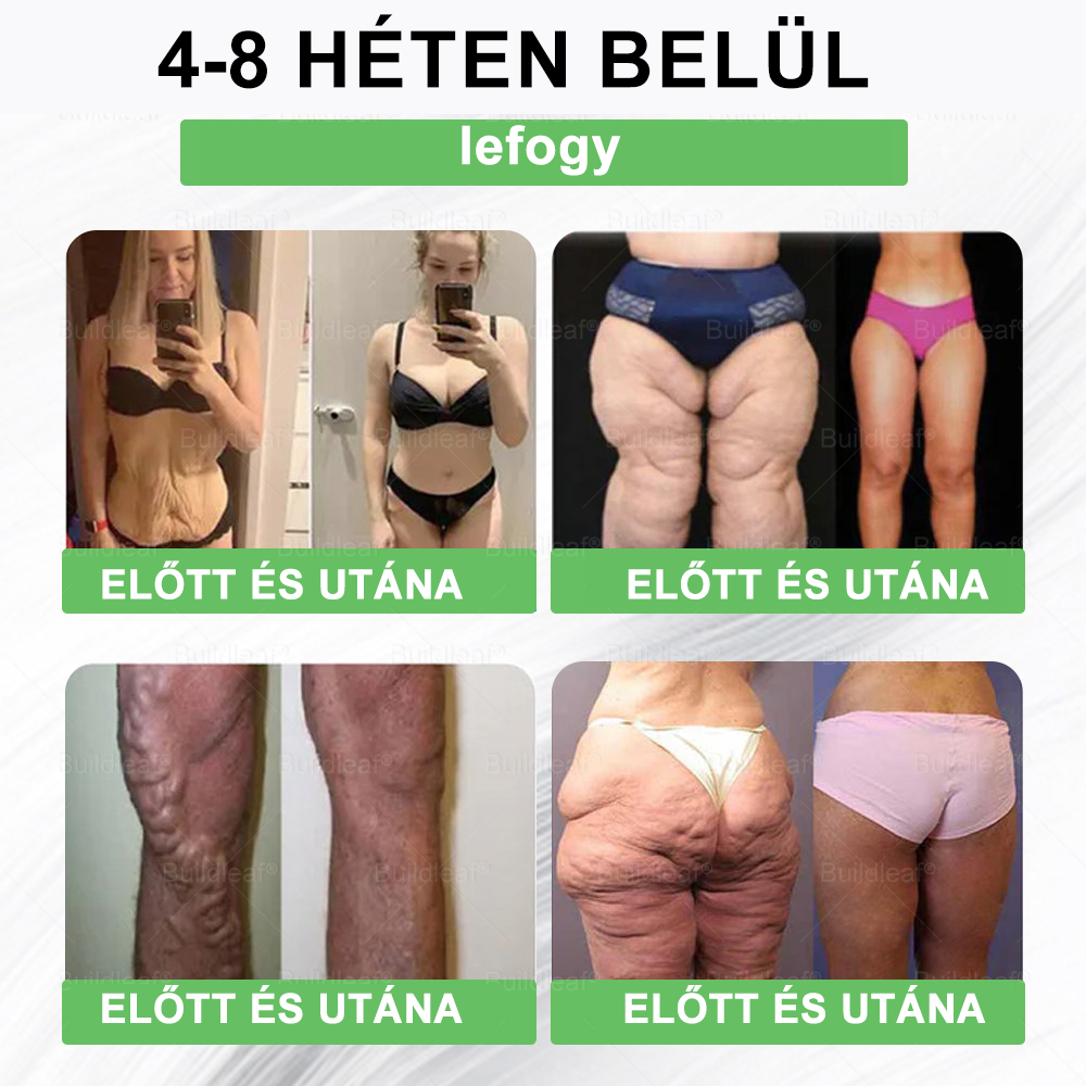 BuildLeaf®🥇 GLP-1 8-az-1-ben Fit &amp; Vital Orális Oldat (Csak napi egyszer, látható változások 7 nap alatt)  Elhízásra, szív- és érrendszeri egészségre, cukorbetegségre, alvási apnoéra, emésztőrendszeri egészségre, ízületi problémákra és még sok másra