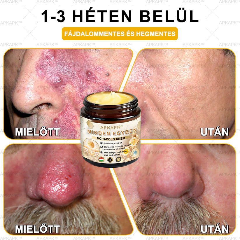 𝐀𝐏𝐊𝐀𝐏𝐊™MéhméregBőrápoló Krém - Jóváhagyva a MagyarDermatológiaiésVenereológiai Társaság (MDDK) és a Nemzeti Népegészségügyi Központ (NNK) által.