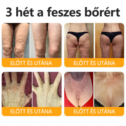 💐🌟💐Magyarországon készült és szállítva✨ VLSVLS® Méhméreg Bőrjavító Krém🔥 Utolsó nap 80% kedvezmény