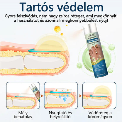 ✨ Timilk® ✨ – 🌿 Gyógynövényes gombaellenes spray körömre és bőrre 🦶