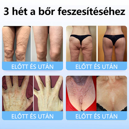 TLOPA™ Kollagén Peptid Erősítő Szérum Stift🎄🎄🎄-Az Országos Népegészségügyi Intézet [NNK] és a Magyar Bőrgyógyászati Társaság [MDDK] ajánlásával.