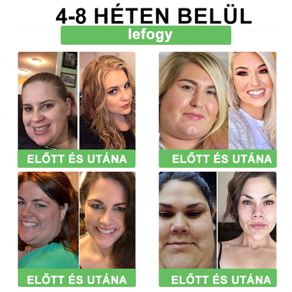 BuildLeaf®🥇 GLP-1 8-az-1-ben Fit &amp; Vital Orális Oldat (Csak napi egyszer, látható változások 7 nap alatt)  Elhízásra, szív- és érrendszeri egészségre, cukorbetegségre, alvási apnoéra, emésztőrendszeri egészségre, ízületi problémákra és még sok másra