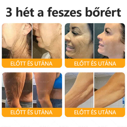 💐🌟💐Magyarországon készült és szállítva✨ VLSVLS® Méhméreg Bőrjavító Krém🔥 Utolsó nap 80% kedvezmény