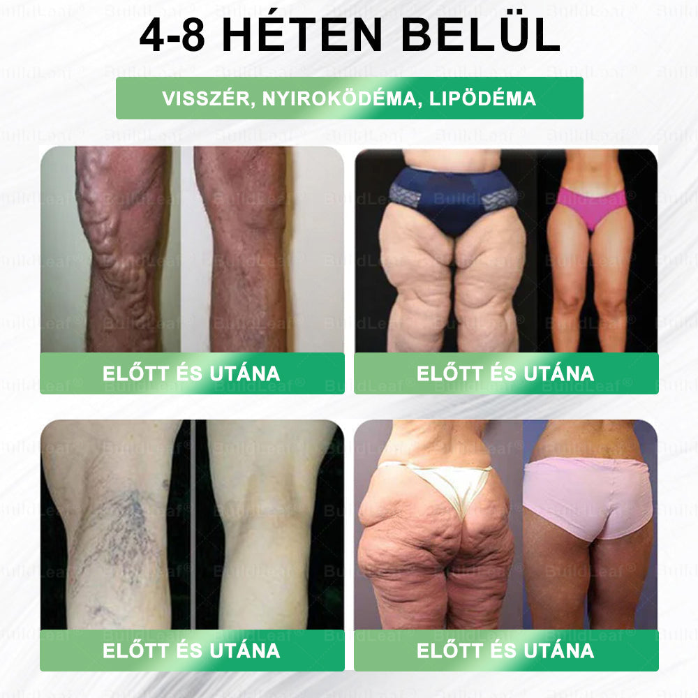 BuildLeaf®🥇 GLP-1 8-az-1-ben Fit &amp; Vital Orális Oldat (Csak napi egyszer, látható változások 7 nap alatt)  Elhízásra, szív- és érrendszeri egészségre, cukorbetegségre, alvási apnoéra, emésztőrendszeri egészségre, ízületi problémákra és még sok másra