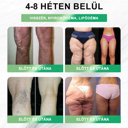 BuildLeaf®🥇 GLP-1 8-az-1-ben Fit &amp; Vital Orális Oldat (Csak napi egyszer, látható változások 7 nap alatt)  Elhízásra, szív- és érrendszeri egészségre, cukorbetegségre, alvási apnoéra, emésztőrendszeri egészségre, ízületi problémákra és még sok másra