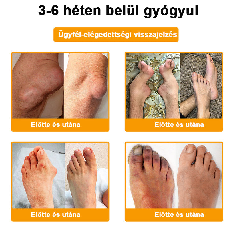 ADNOON® Botulinum Toxin & Méhméreg Fájdalomcsillapító Csontgyógyító Krém⭐👨‍⚕️A Magyar Ortopéd Társaság (MOT) Által Jóváhagyva