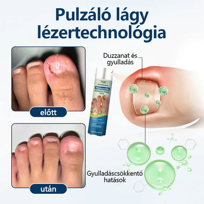 ✨ Timilk® ✨ – 🌿 Gyógynövényes gombaellenes spray körömre és bőrre 🦶