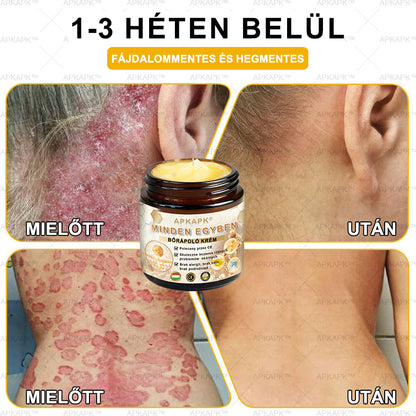 𝐀𝐏𝐊𝐀𝐏𝐊™MéhméregBőrápoló Krém - Jóváhagyva a MagyarDermatológiaiésVenereológiai Társaság (MDDK) és a Nemzeti Népegészségügyi Központ (NNK) által.