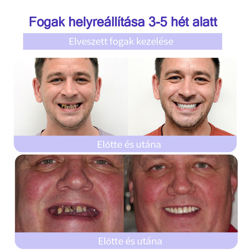 𝖦𝖺𝗋𝖺𝗀𝖾𝖫𝗂𝗇𝖾™ 𝖥𝗈𝗀𝖺𝗄 𝗁𝖾𝗅𝗒𝗋𝖾á𝗅𝗅í𝗍á𝗌𝖺 Á𝗌𝗏á𝗇𝗒𝗂 𝗉𝗈𝗋🦷 (MFK által ajánlott) (👨🏻‍⚕️(Korlátozott idejű ajánlat - ne hagyja ki)👨🏻‍⚕️)
