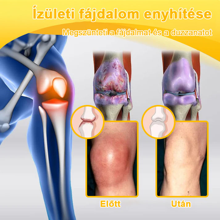 ADNOON® Botulinum Toxin & Méhméreg Fájdalomcsillapító Csontgyógyító Krém⭐👨‍⚕️A Magyar Ortopéd Társaság (MOT) Által Jóváhagyva