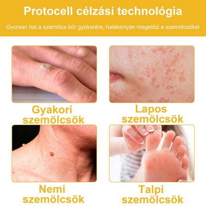 🐝✨𝑩𝑺𝑾𝑬𝑳𝑳® 𝑴é𝒉𝒎é𝒓𝒆𝒈 𝑲𝒆𝒛𝒆𝒍é𝒔 𝑲𝒓é𝒎👨‍⚕️（𝑫𝒆𝒓𝒎𝒂𝒕𝒐𝒍ó𝒈𝒖𝒔 𝒂𝒋á𝒏𝒍á𝒔𝒐𝒌） (🔥𝒖𝒕𝒐𝒍𝒔ó 𝒏𝒂𝒑 𝒑𝒓𝒐𝒎ó𝒄𝒊ó 80% 𝒌𝒊）