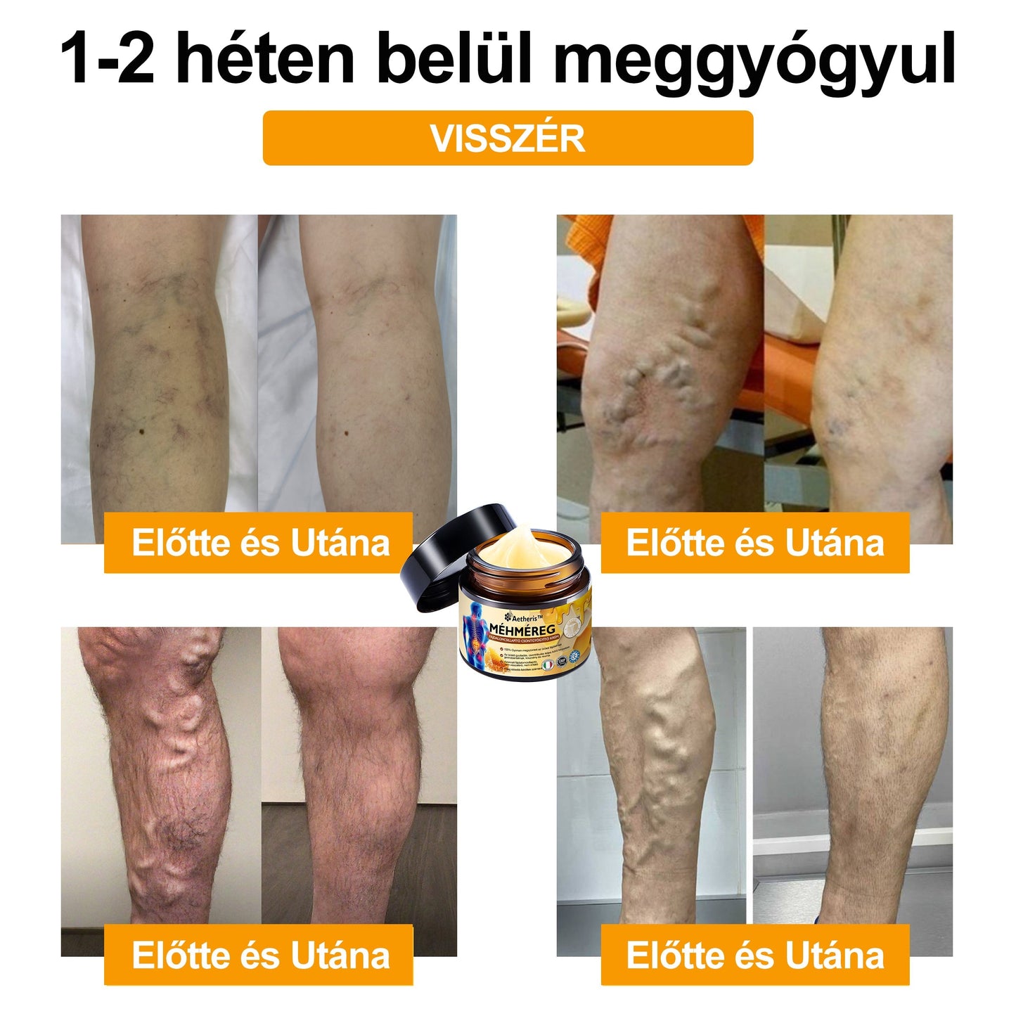 𝑯𝒊𝒗𝒂𝒕𝒂𝒍𝒐𝒔 𝒃𝒐𝒍𝒕: 𝑨𝒆𝒕𝒉𝒆𝒓𝒊𝒔™ 𝑴é𝒉𝒎é𝒓𝒆𝒈 𝑨𝒛𝒐𝒏𝒏𝒂𝒍𝒊 𝑼𝒍𝒕𝒓𝒂 𝑬𝒓ő𝒔 𝑭á𝒋𝒅𝒂𝒍𝒐𝒎𝒄𝒔𝒊𝒍𝒍𝒂𝒑í𝒕ó 𝑲𝒓é𝒎 - 💪💪(𝑬𝒏𝒚𝒉í𝒕𝒊 𝒂 𝒇á𝒋𝒅𝒂𝒍𝒎𝒂𝒕 í𝒛ü𝒍𝒆𝒕𝒊 𝒈𝒚𝒖𝒍𝒍𝒂𝒅á𝒔, 𝒊𝒛𝒐𝒎𝒇á𝒋𝒅𝒂𝒍𝒐𝒎, 𝒉á𝒕𝒇á𝒋á𝒔, 𝒕é𝒓𝒅𝒆𝒌, 𝒉á𝒕, 𝒗á𝒍𝒍𝒂𝒌, 𝒄𝒔í𝒑ő𝒌, 𝒄𝒔𝒖𝒌𝒍ó𝒌, 𝒌𝒆𝒛𝒆𝒌 𝒆𝒔𝒆𝒕é𝒏)