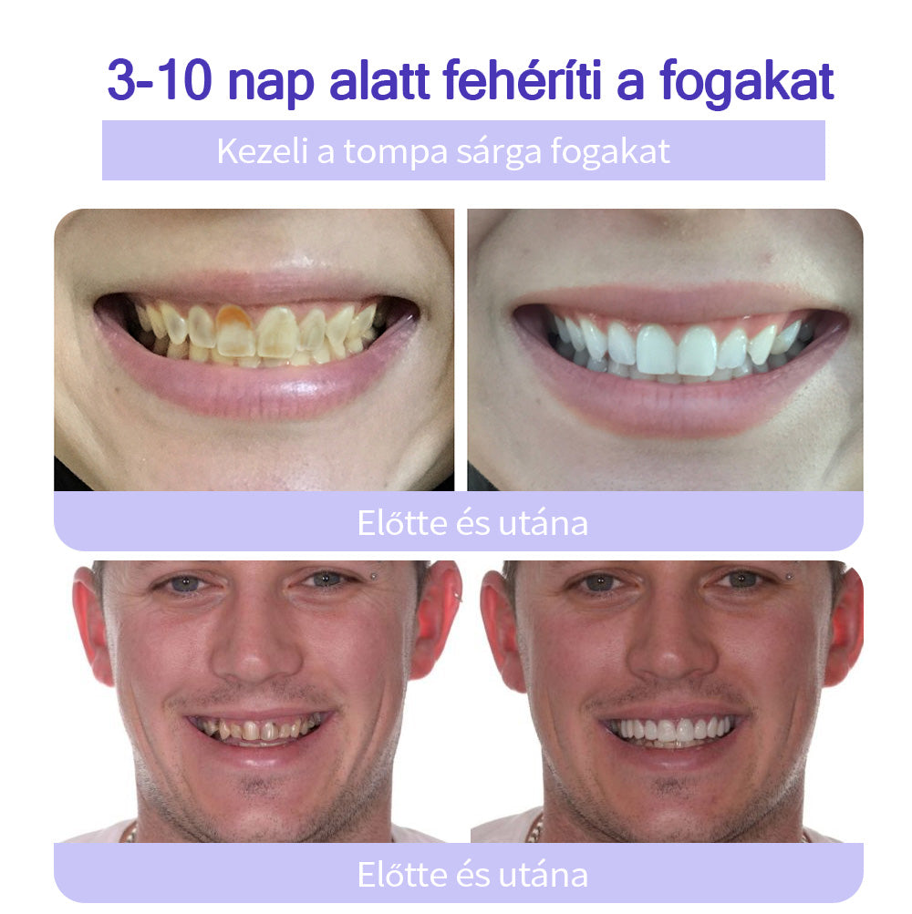 𝖦𝖺𝗋𝖺𝗀𝖾𝖫𝗂𝗇𝖾™ 𝖥𝗈𝗀𝖺𝗄 𝗁𝖾𝗅𝗒𝗋𝖾á𝗅𝗅í𝗍á𝗌𝖺 Á𝗌𝗏á𝗇𝗒𝗂 𝗉𝗈𝗋🦷 (MFK által ajánlott) (👨🏻‍⚕️(Korlátozott idejű ajánlat - ne hagyja ki)👨🏻‍⚕️)