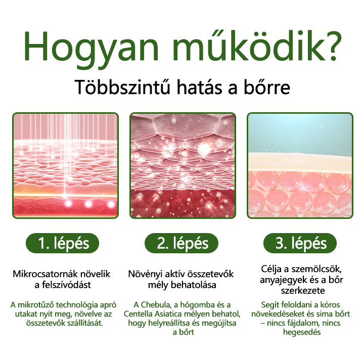 👨‍⚕️Timilk® Dél-Korea WartClear Intenzív Ampulla