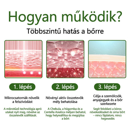 👨‍⚕️Timilk® Dél-Korea WartClear Intenzív Ampulla
