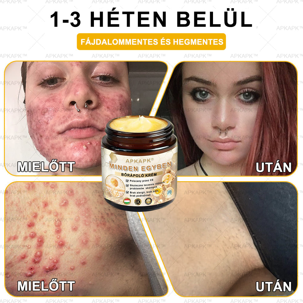 𝐀𝐏𝐊𝐀𝐏𝐊™MéhméregBőrápoló Krém - Jóváhagyva a MagyarDermatológiaiésVenereológiai Társaság (MDDK) és a Nemzeti Népegészségügyi Központ (NNK) által.