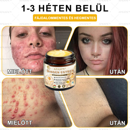 𝐀𝐏𝐊𝐀𝐏𝐊™MéhméregBőrápoló Krém - Jóváhagyva a MagyarDermatológiaiésVenereológiai Társaság (MDDK) és a Nemzeti Népegészségügyi Központ (NNK) által.